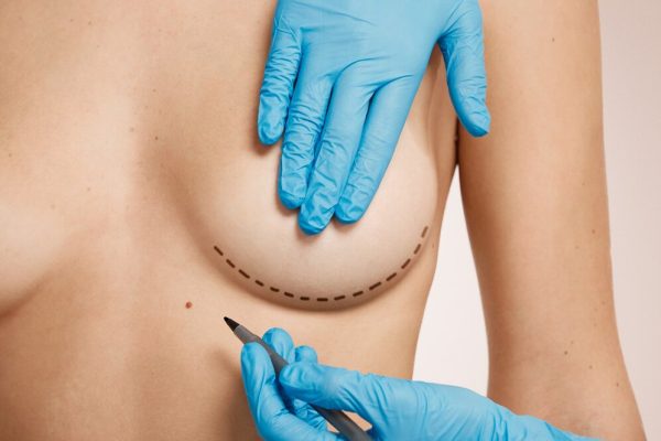 Growing a Thriving Business in Aesthetic Surgery: Gynecomastia Surgeon